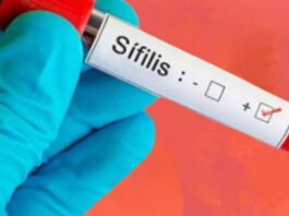 República Dominicana registra 621 casos de sífilis en 2025