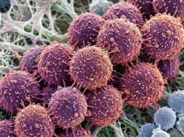 Antioxidante glutatión puede «alimentar» al cáncer