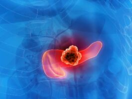 Avance científico revoluciona lucha contra el cáncer de páncreas