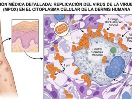 Confirmados dos casos de viruela símica en San Cristóbal